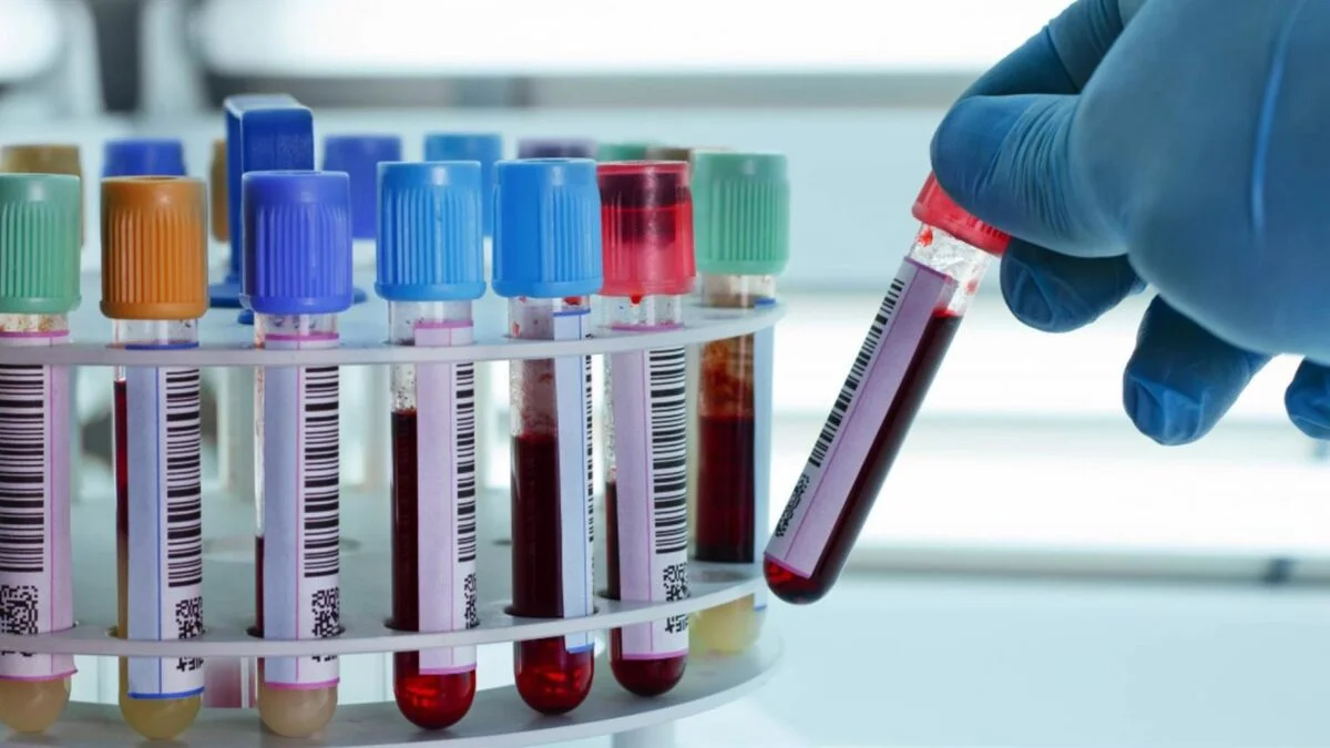 Warburg Pincus se prepara para adquirir más del 30% de participación en Sebia, la innovadora firma francesa