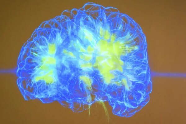 ¿Puede la Inteligencia Artificial Desarrollarse y Adaptarse como un Cerebro Humano?