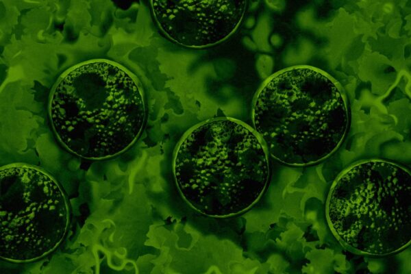 Brote de cicloforesis: el CDC informa la expansión del parásito a 4 nuevos estados y recomendaciones para evitar la lechuga contaminada.