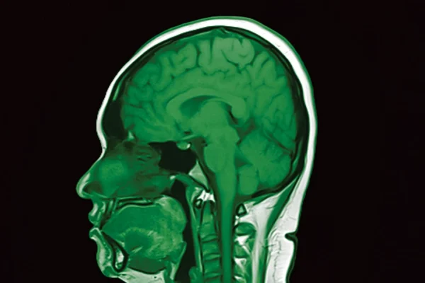 Revolución en neurología: Inician ensayos clínicos con proteínas diseñadas que sorprenden a los científicos en EE. UU.