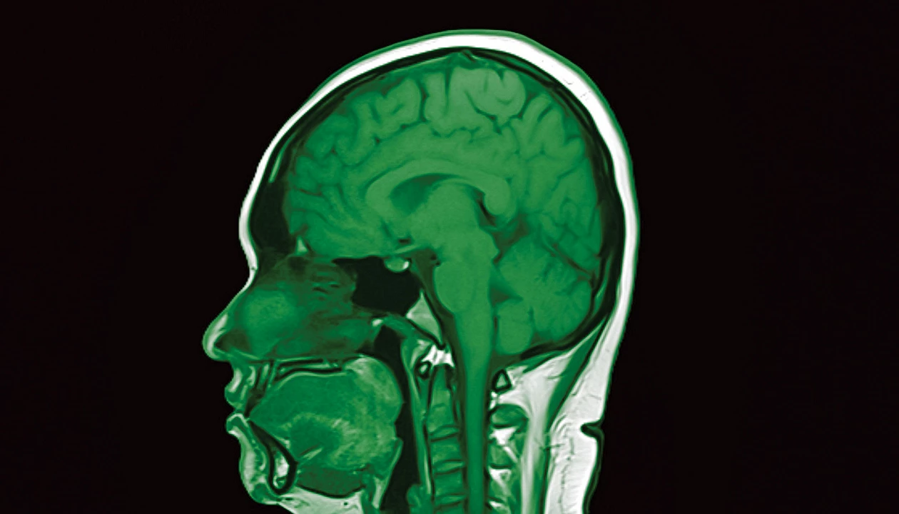 Revolución en neurología: Inician ensayos clínicos con proteínas diseñadas que sorprenden a los científicos en EE. UU.