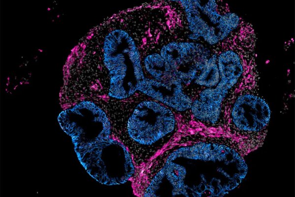 Intero Biosystems propone ensayar medicamentos en intestinos humanos en miniatura en lugar de utilizar animales.