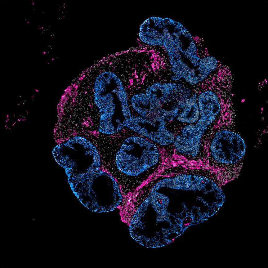 Intero Biosystems propone ensayar medicamentos en intestinos humanos en miniatura en lugar de utilizar animales.